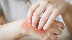 Little Red Bumps on Your Skin